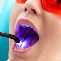 Гигиена полости рта. Чистка зубов и полости рта от камня и налета